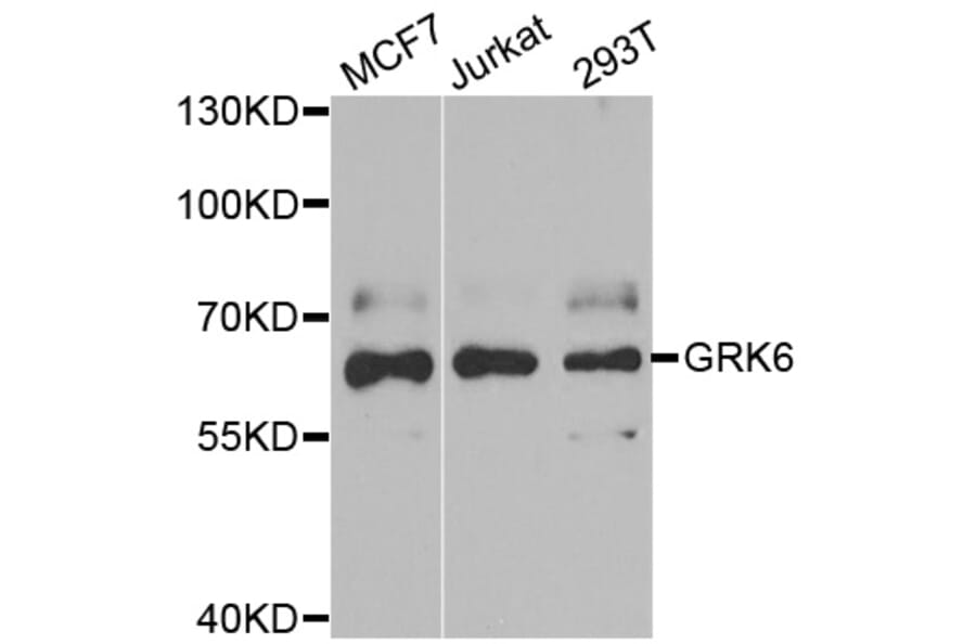 Western blot - GRK6 antibody from Signalway Antibody (38862) - Antibodies.com