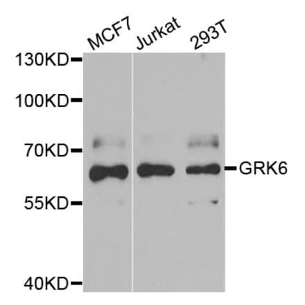 Western blot - GRK6 antibody from Signalway Antibody (38862) - Antibodies.com
