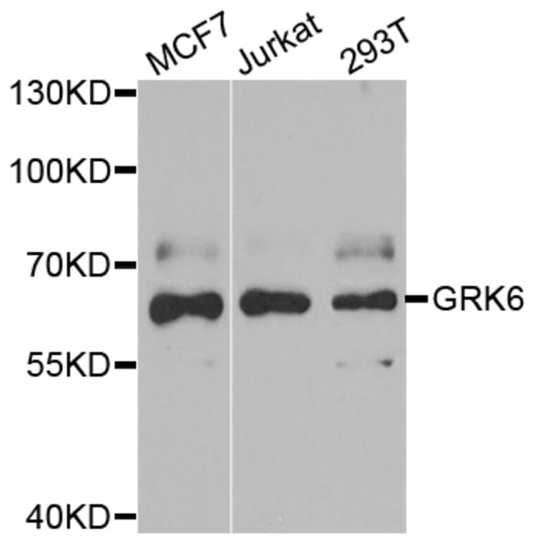 Western blot - GRK6 antibody from Signalway Antibody (38862) - Antibodies.com