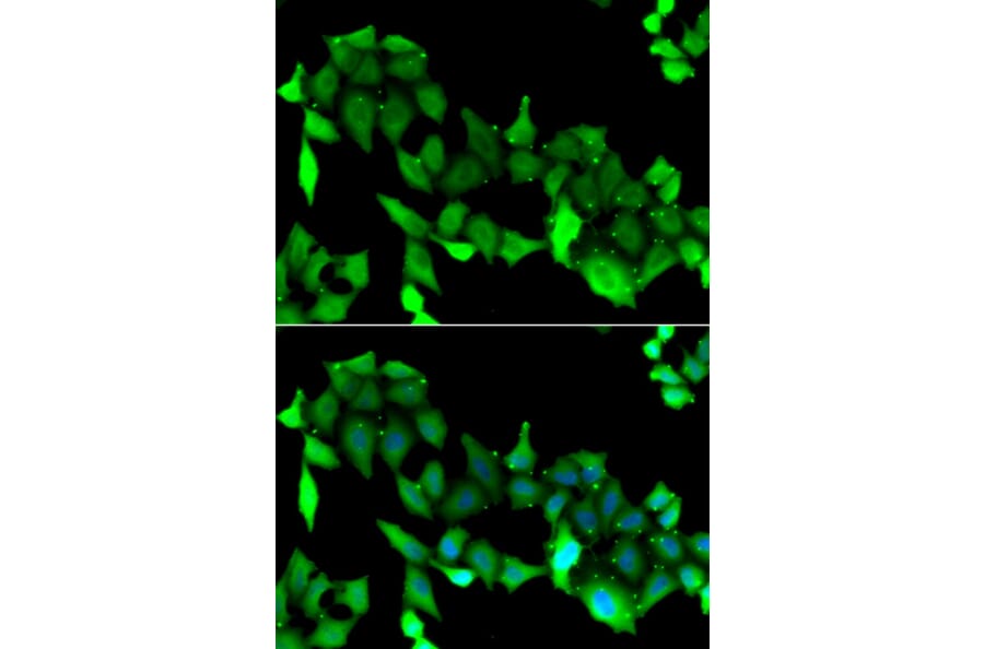 Immunofluorescence - GRK6 antibody from Signalway Antibody (38862) - Antibodies.com