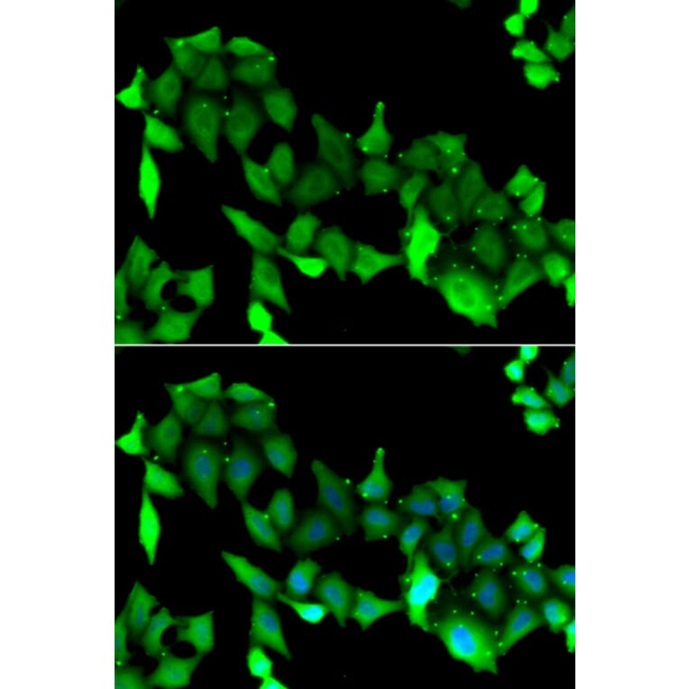 Immunofluorescence - GRK6 antibody from Signalway Antibody (38862) - Antibodies.com