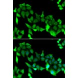 Immunofluorescence - GRK6 antibody from Signalway Antibody (38862) - Antibodies.com