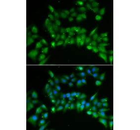 Immunofluorescence - ISL1 antibody from Signalway Antibody (38866) - Antibodies.com