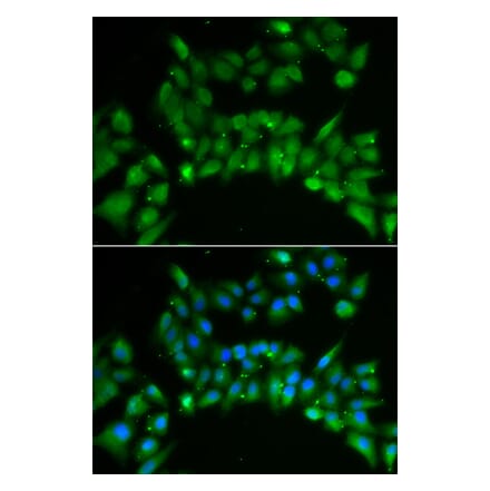 Immunofluorescence - ISL1 antibody from Signalway Antibody (38866) - Antibodies.com