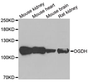 Western blot - OGDH antibody from Signalway Antibody (38871) - Antibodies.com
