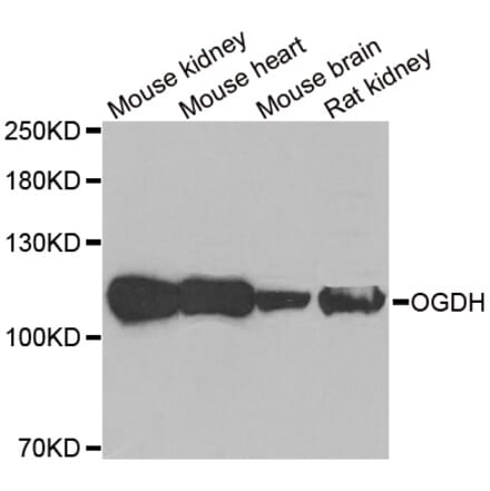 Western blot - OGDH antibody from Signalway Antibody (38871) - Antibodies.com