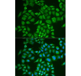 Immunofluorescence - PNOC antibody from Signalway Antibody (38875) - Antibodies.com