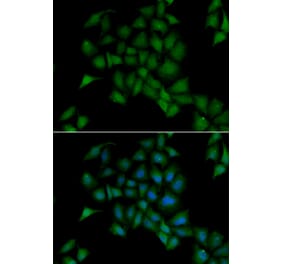 Immunofluorescence - PPOX antibody from Signalway Antibody (38877) - Antibodies.com