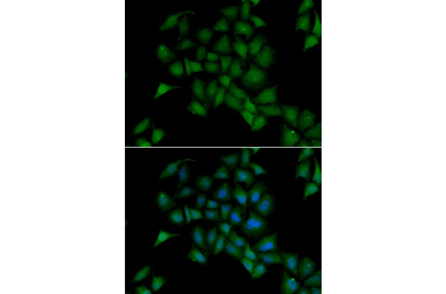 Immunofluorescence - PPOX antibody from Signalway Antibody (38877) - Antibodies.com