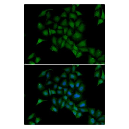 Immunofluorescence - PPOX antibody from Signalway Antibody (38877) - Antibodies.com