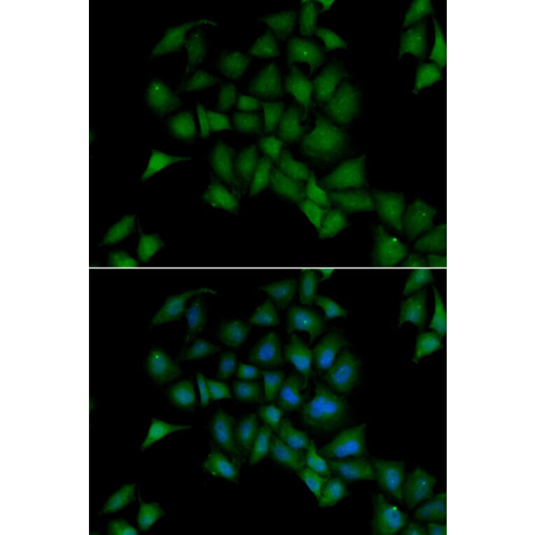 Immunofluorescence - PPOX antibody from Signalway Antibody (38877) - Antibodies.com