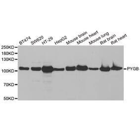 Western blot - PYGB antibody from Signalway Antibody (38881) - Antibodies.com