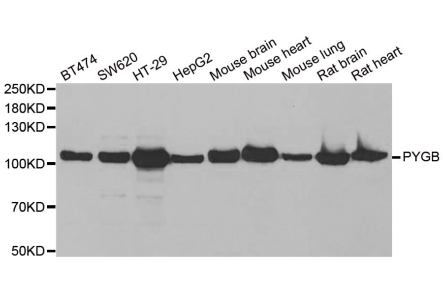 Western blot - PYGB antibody from Signalway Antibody (38881) - Antibodies.com