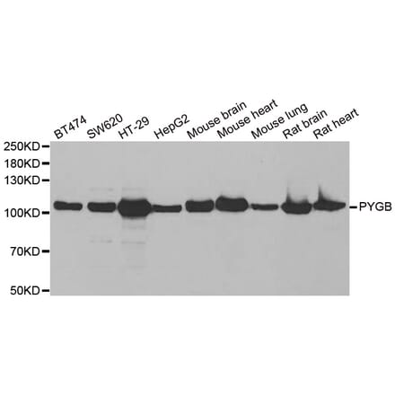 Western blot - PYGB antibody from Signalway Antibody (38881) - Antibodies.com