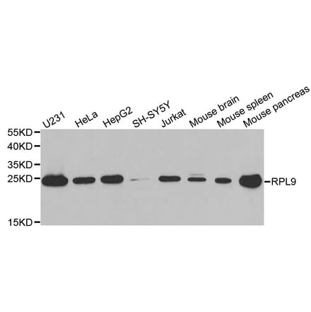 Western blot - RPL9 antibody from Signalway Antibody (38885) - Antibodies.com