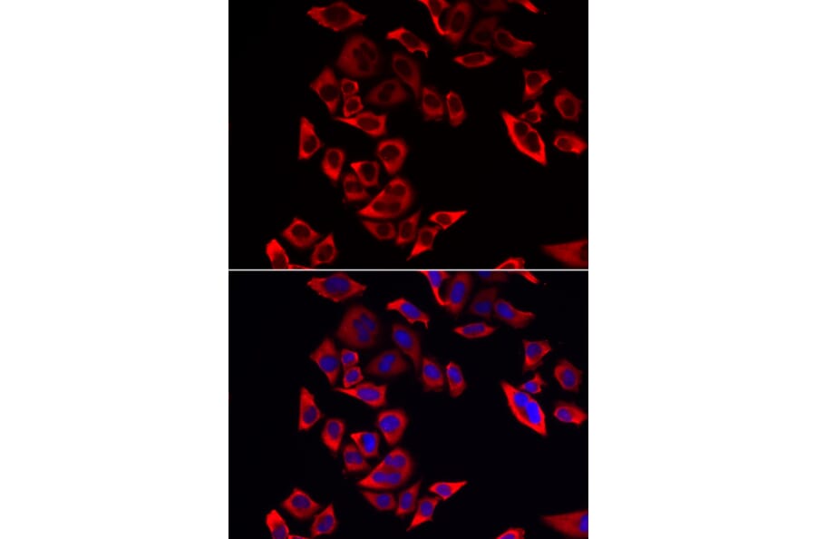 Immunofluorescence - RPL9 antibody from Signalway Antibody (38885) - Antibodies.com