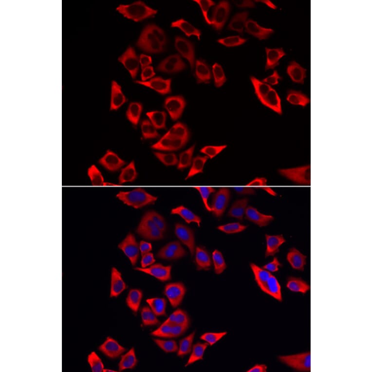 Immunofluorescence - RPL9 antibody from Signalway Antibody (38885) - Antibodies.com