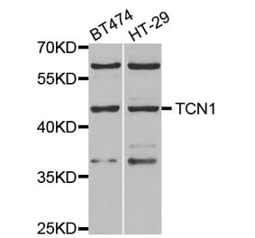 Western blot - TCN1 antibody from Signalway Antibody (38893) - Antibodies.com