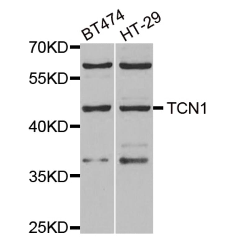 Western blot - TCN1 antibody from Signalway Antibody (38893) - Antibodies.com