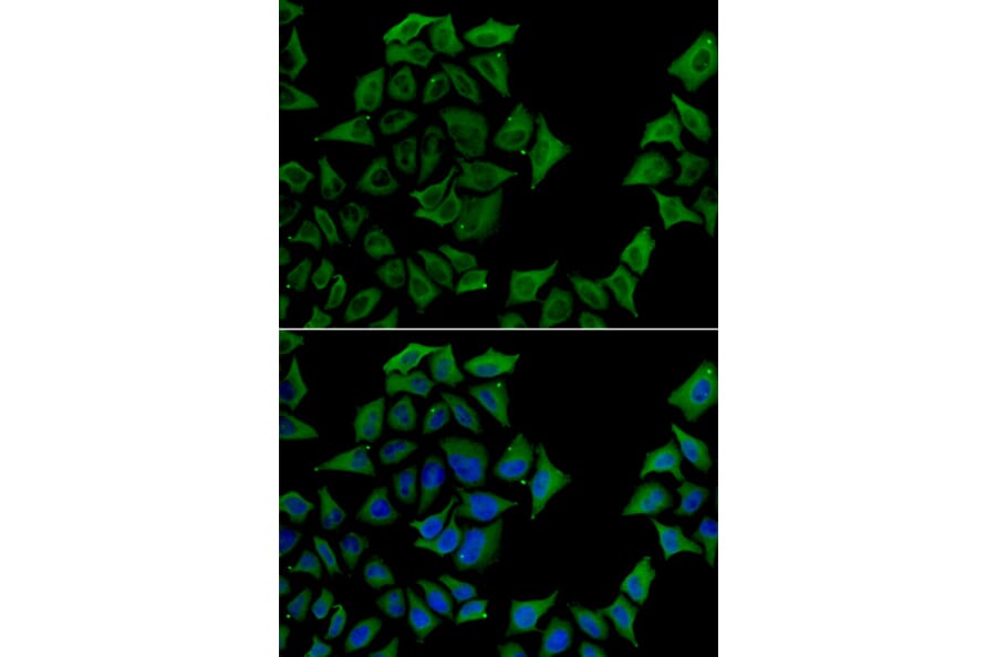 Immunofluorescence - TCN1 antibody from Signalway Antibody (38893) - Antibodies.com