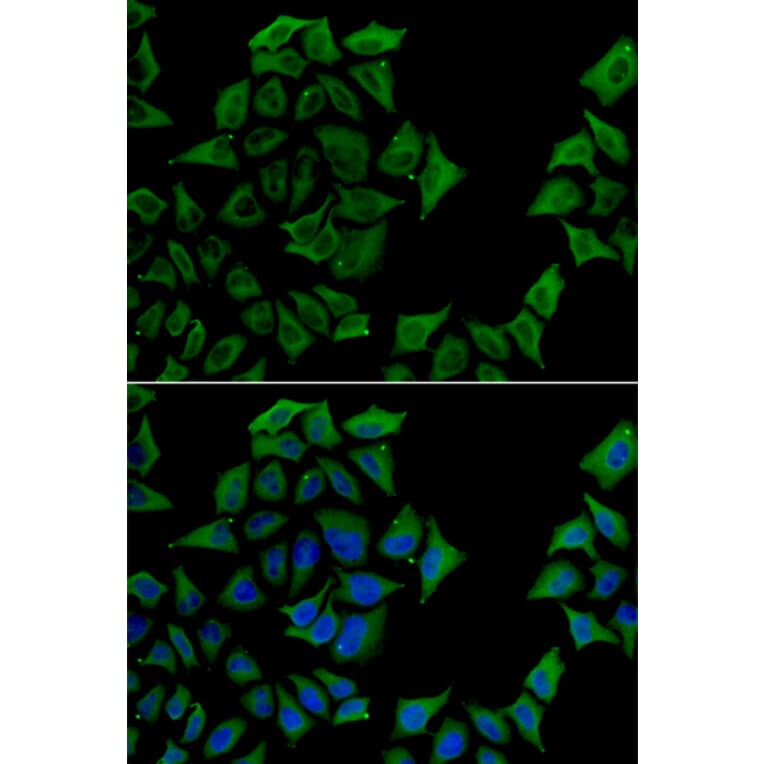 Immunofluorescence - TCN1 antibody from Signalway Antibody (38893) - Antibodies.com