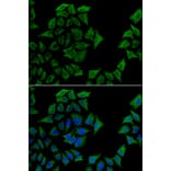 Immunofluorescence - TCN1 antibody from Signalway Antibody (38893) - Antibodies.com
