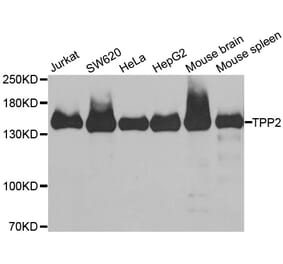 Western blot - TPP2 antibody from Signalway Antibody (38899) - Antibodies.com