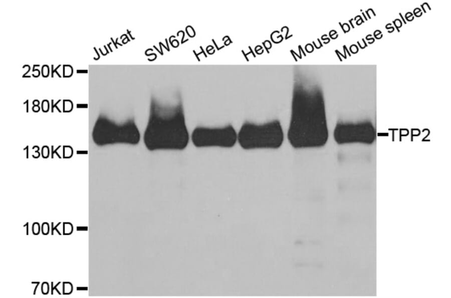 Western blot - TPP2 antibody from Signalway Antibody (38899) - Antibodies.com