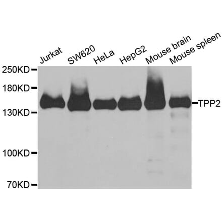 Western blot - TPP2 antibody from Signalway Antibody (38899) - Antibodies.com