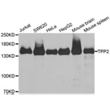 Western blot - TPP2 antibody from Signalway Antibody (38899) - Antibodies.com