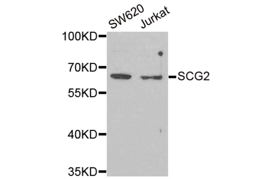Western blot - SCG2 antibody from Signalway Antibody (38903) - Antibodies.com