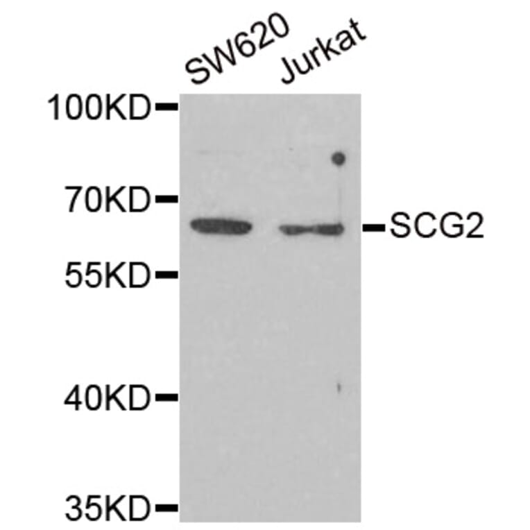 Western blot - SCG2 antibody from Signalway Antibody (38903) - Antibodies.com