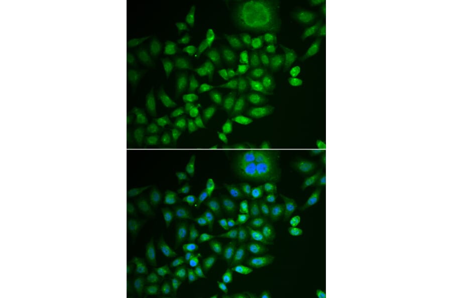 Immunofluorescence - SCG2 antibody from Signalway Antibody (38903) - Antibodies.com