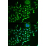 Immunofluorescence - SCG2 antibody from Signalway Antibody (38903) - Antibodies.com