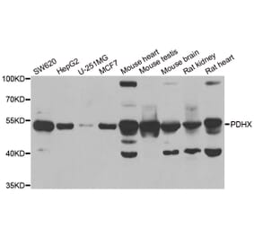 Western blot - PDHX antibody from Signalway Antibody (38904) - Antibodies.com