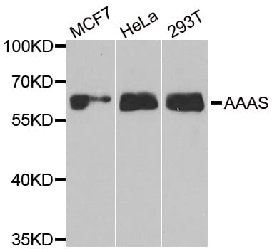 Western blot analysis of extracts of various cell lines, using AAAS antibody.