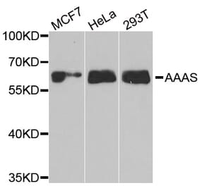 Western blot - AAAS antibody from Signalway Antibody (38905) - Antibodies.com