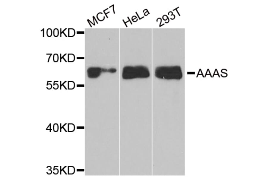 Western blot - AAAS antibody from Signalway Antibody (38905) - Antibodies.com