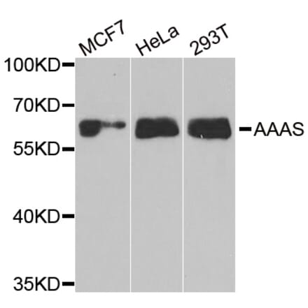 Western blot - AAAS antibody from Signalway Antibody (38905) - Antibodies.com