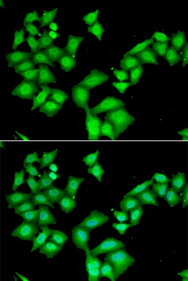 Immunofluorescence analysis of HeLa cell using AAAS antibody. Blue: DAPI for nuclear staining.