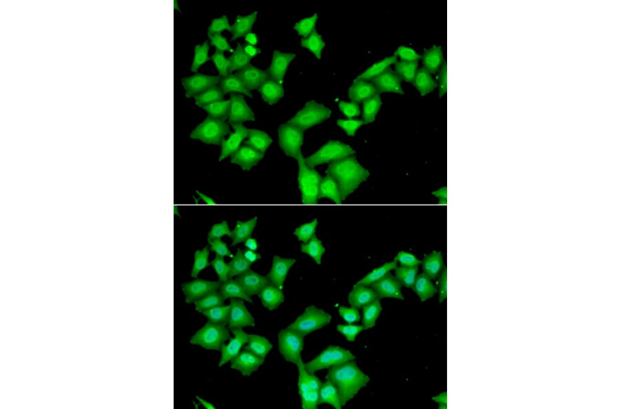 Immunofluorescence - AAAS antibody from Signalway Antibody (38905) - Antibodies.com
