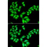 Immunofluorescence - AAAS antibody from Signalway Antibody (38905) - Antibodies.com