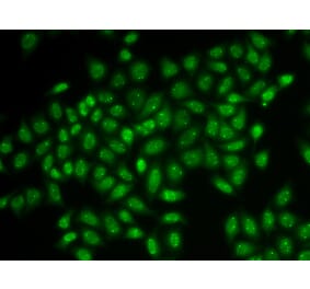 Immunofluorescence - COIL antibody from Signalway Antibody (38906) - Antibodies.com