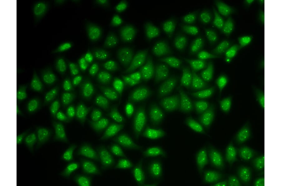 Immunofluorescence - COIL antibody from Signalway Antibody (38906) - Antibodies.com