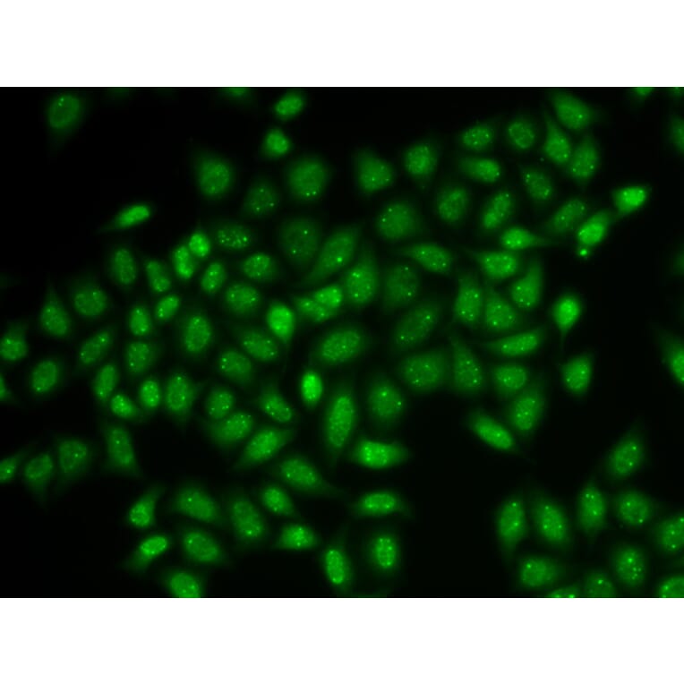 Immunofluorescence - COIL antibody from Signalway Antibody (38906) - Antibodies.com