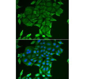 Immunofluorescence - CD84 antibody from Signalway Antibody (38911) - Antibodies.com