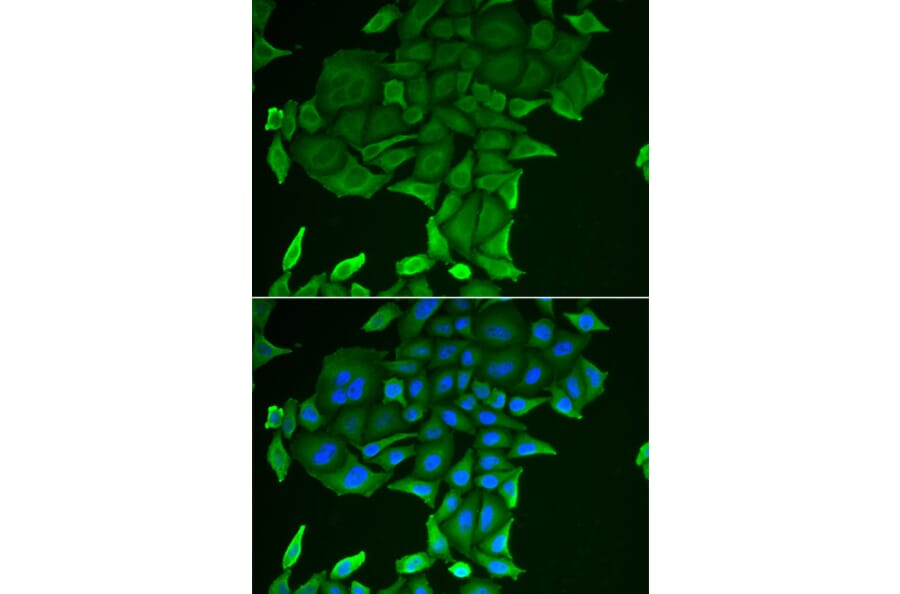 Immunofluorescence - CD84 antibody from Signalway Antibody (38911) - Antibodies.com