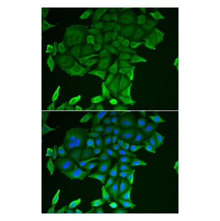 Immunofluorescence - CD84 antibody from Signalway Antibody (38911) - Antibodies.com
