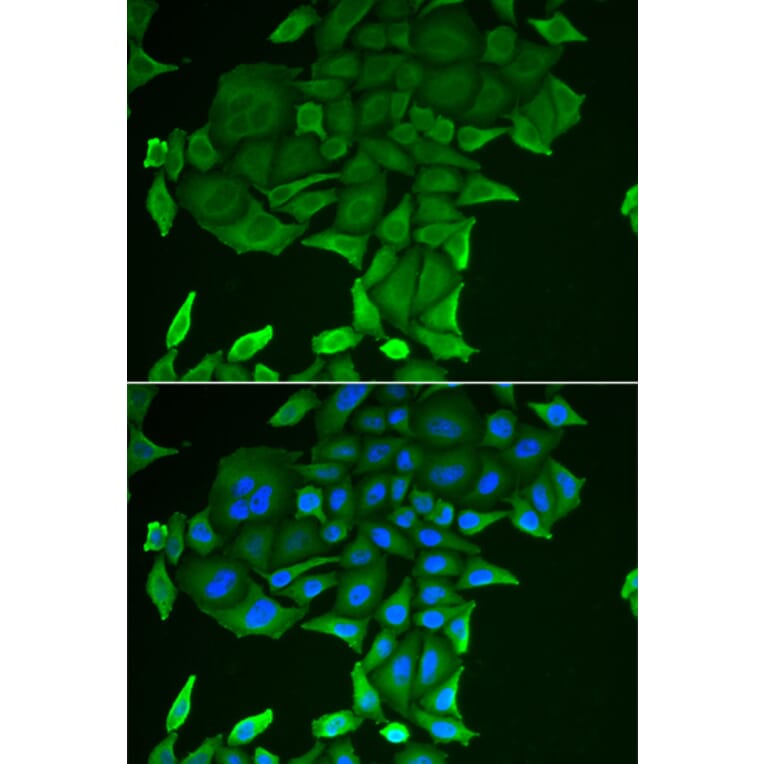 Immunofluorescence - CD84 antibody from Signalway Antibody (38911) - Antibodies.com