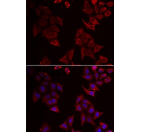 Immunofluorescence - NCR1 antibody from Signalway Antibody (38916) - Antibodies.com